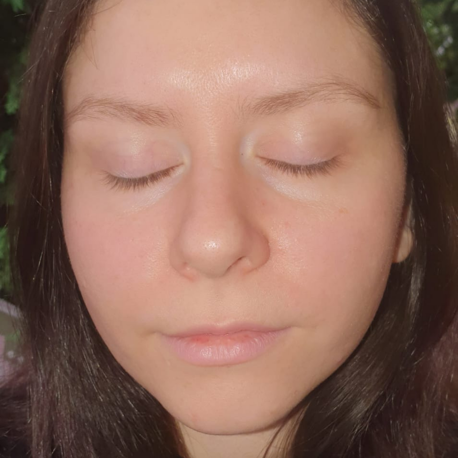 image comparison after